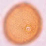 pubescens